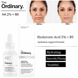 حمض الهيالورونيك + بي 5 من ذا اورديناري - 30مل