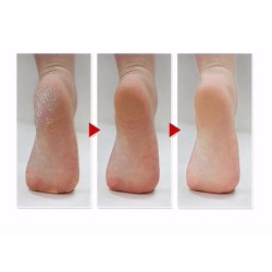 جوارب تقشير القدمين من ام بيوتي